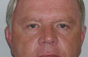 Brow-lift-&-lids-after.jpg